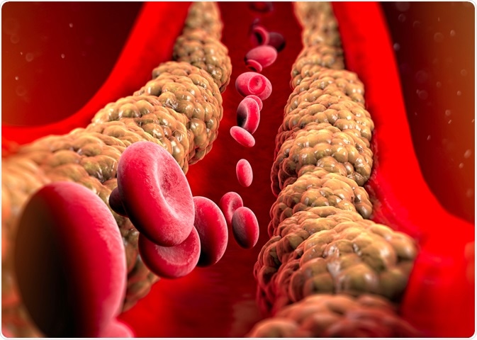 Triglycerides - What do they do?