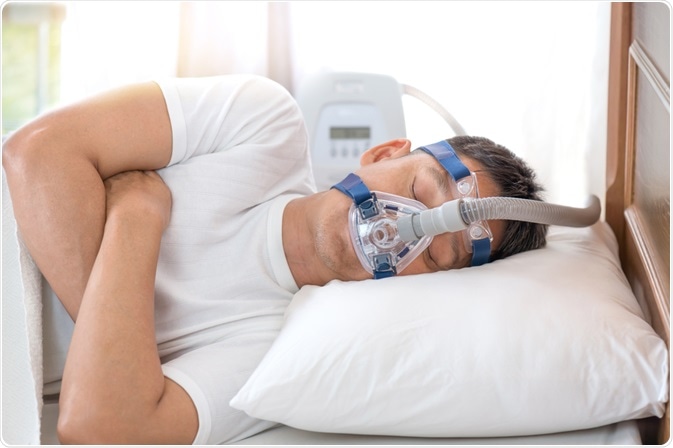 Guide to Anti-Snoring Devices