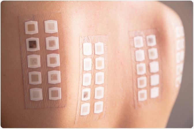 Patch test skin