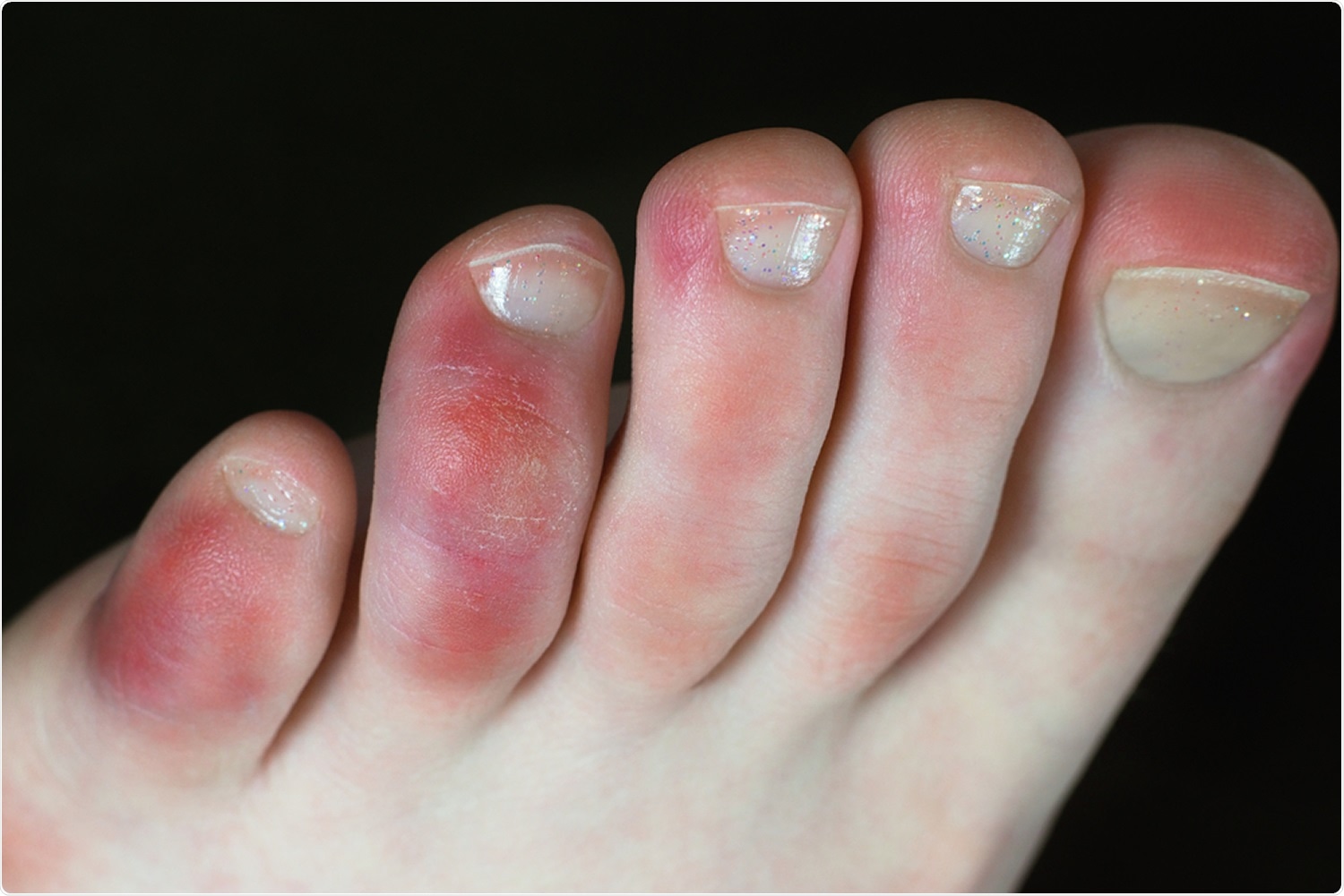 symptoms in the feet