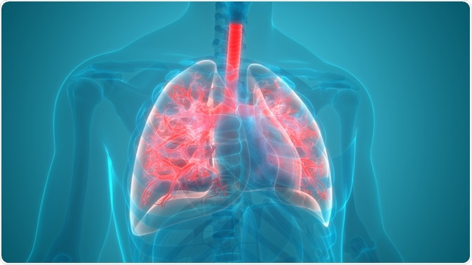 bacterial pneumonia cell