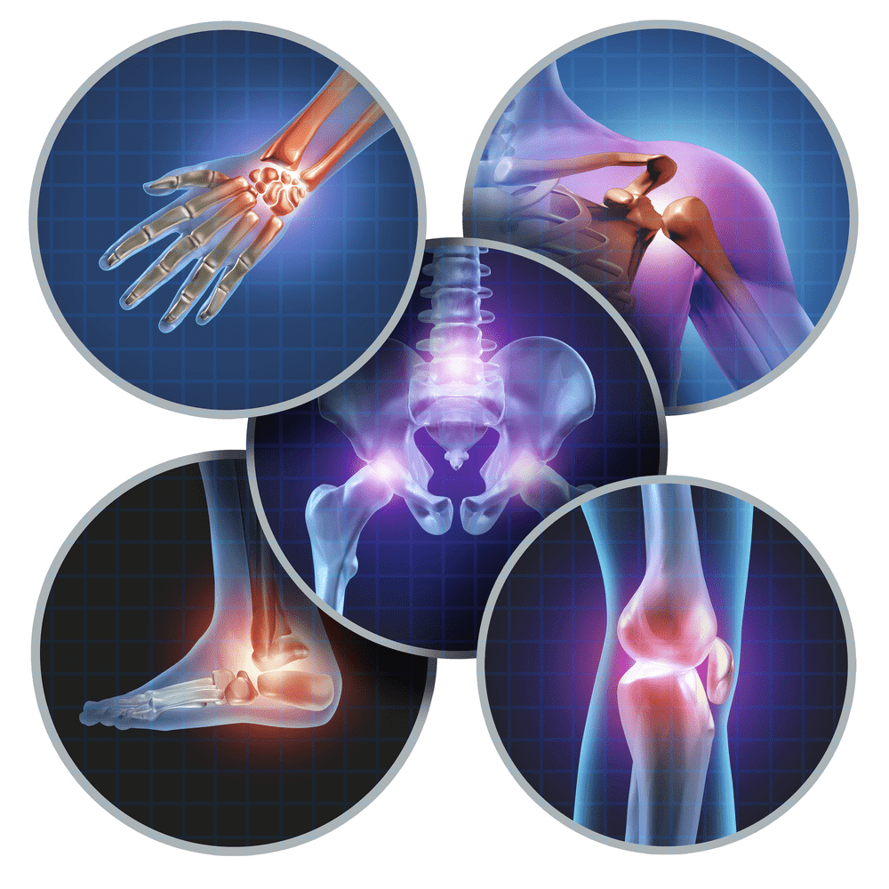 osteoarthritis treatment