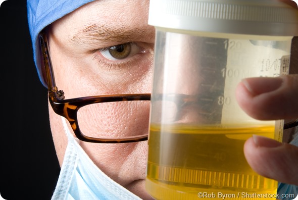 Reducing contamination rates in urine samples: an interview with Prof.  Frank Chinegwundoh MBE