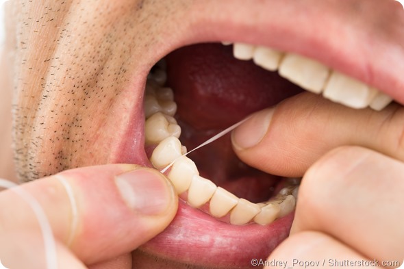 samle overliggende Ryg, ryg, ryg del Flossgate & the Importance of Preventative Oral Hygiene