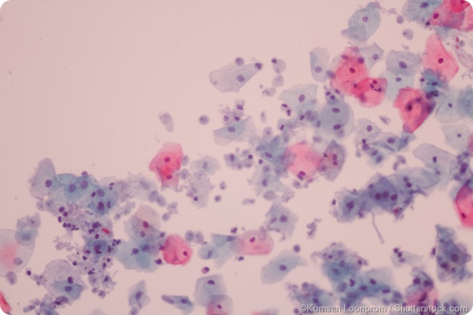 Bakteriális vaginózis Trichomonas gardnerella