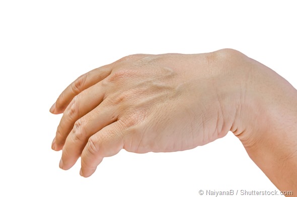 Ganglion