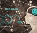 What is Dopamine?