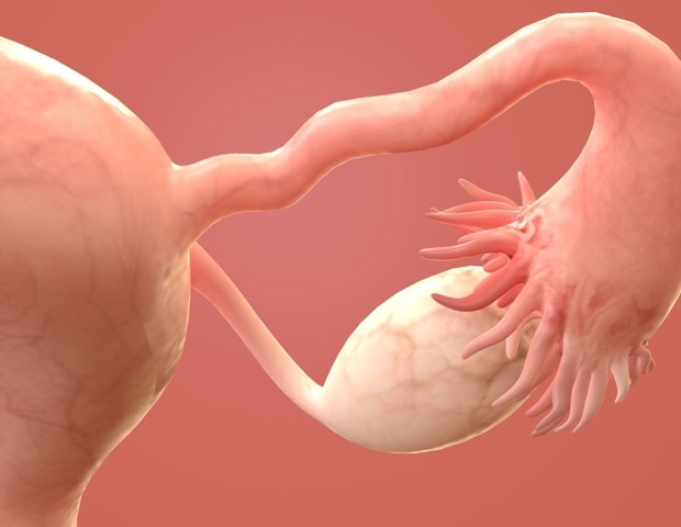 Ovarian Microbiome Overview: Fertility, PCOS, and the Gut–Ovary Axis
