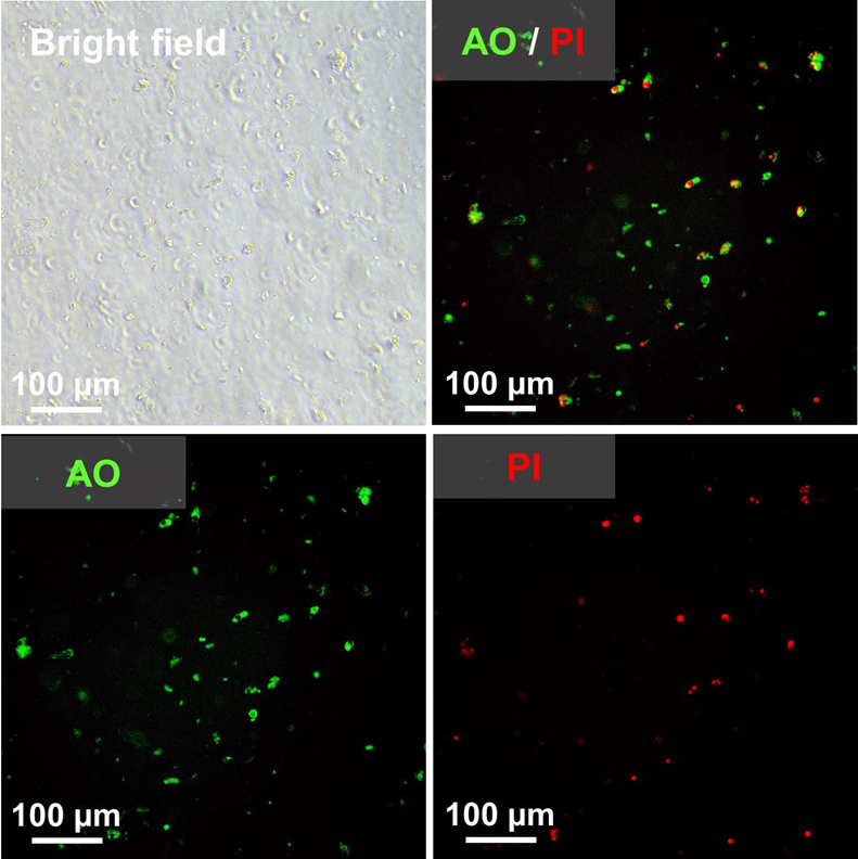 Targeted proteomics for accurate P-glycoprotein quantification