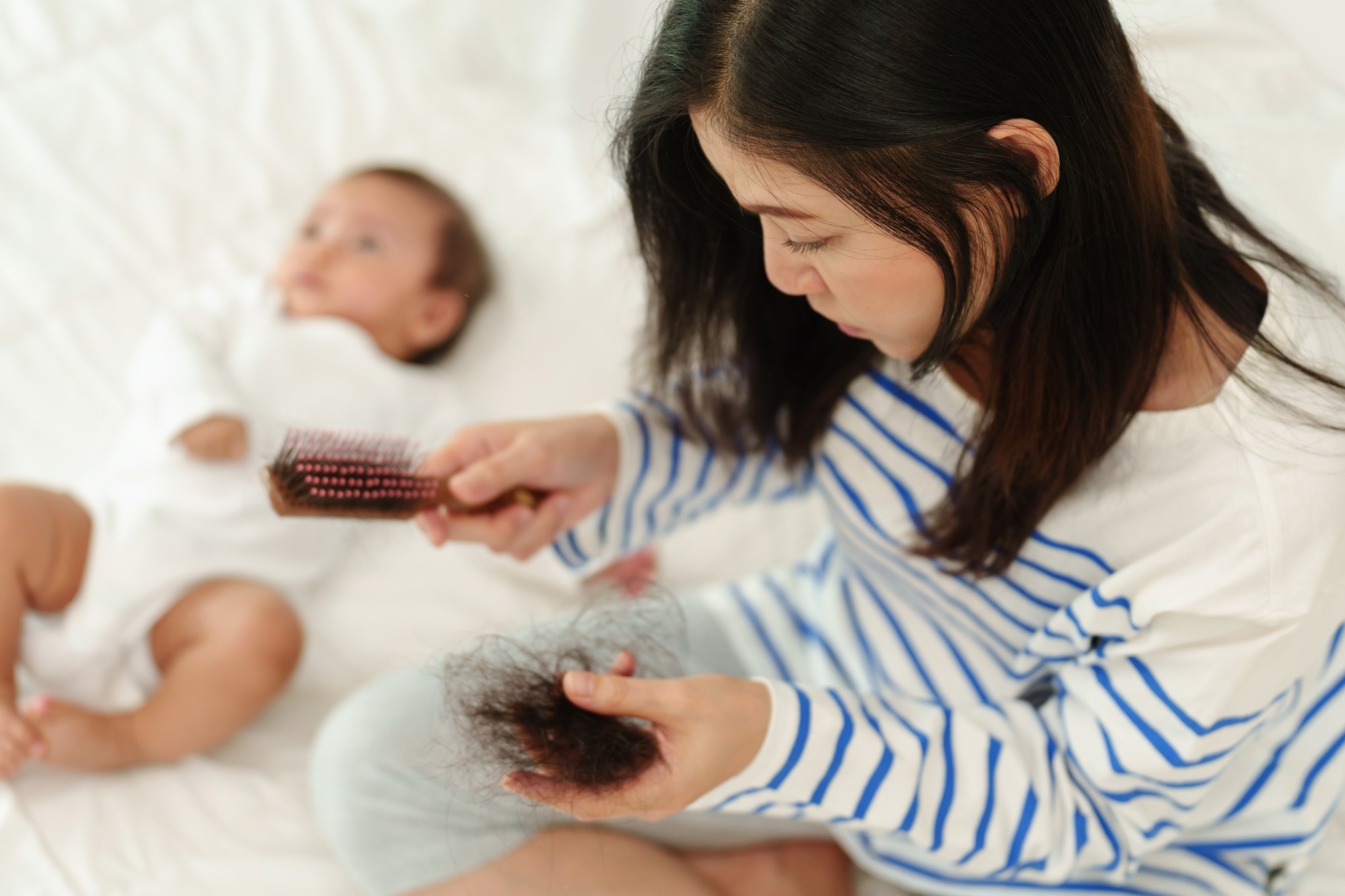 New mother with postpartum hair loss.