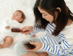 Postpartum Hair Loss: Causes, Timeline, and When to Worry
