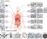 ADC efficacy and safety evaluation using advanced organoid models
