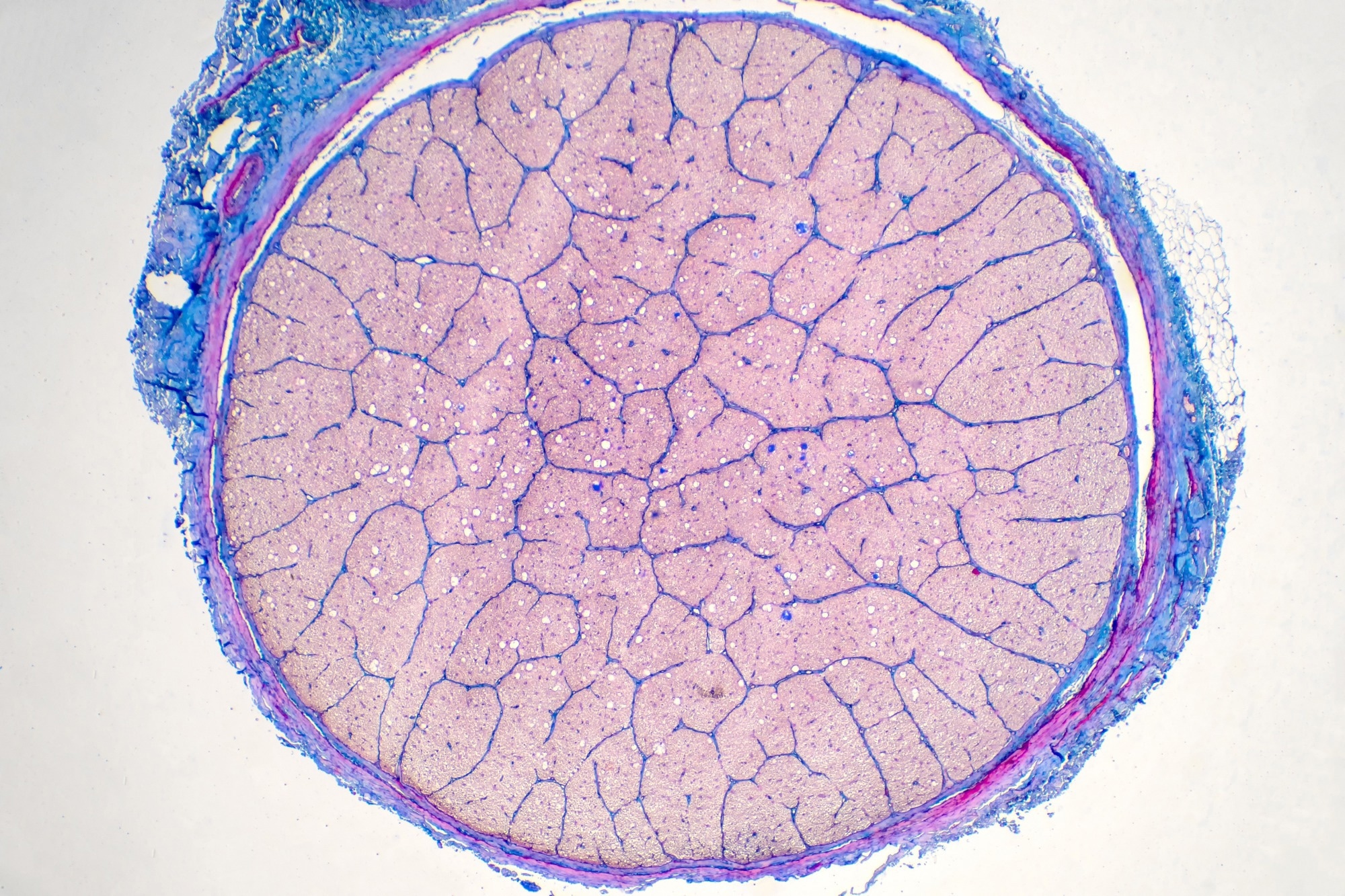 Human eye nerve under the microscope view. Histological for human pathology.