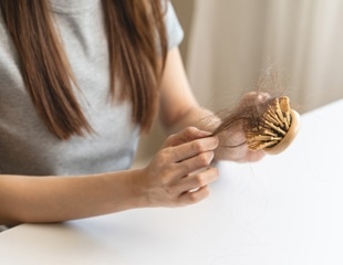 What Causes Hair Loss in Women? Hormones, Aging, and Genetics Explained