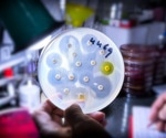 How Soil Bacteria Could Help Solve Antibiotic Resistance