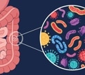 How Diet Influences the Gut Microbiome and Overall Health