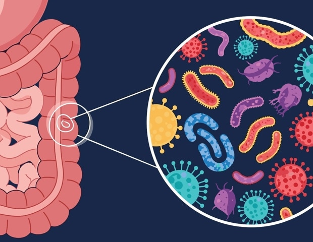 How Diet Influences the Gut Microbiome and Overall Health