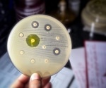 What are ESKAPE Pathogens and Why are They So Dangerous?
