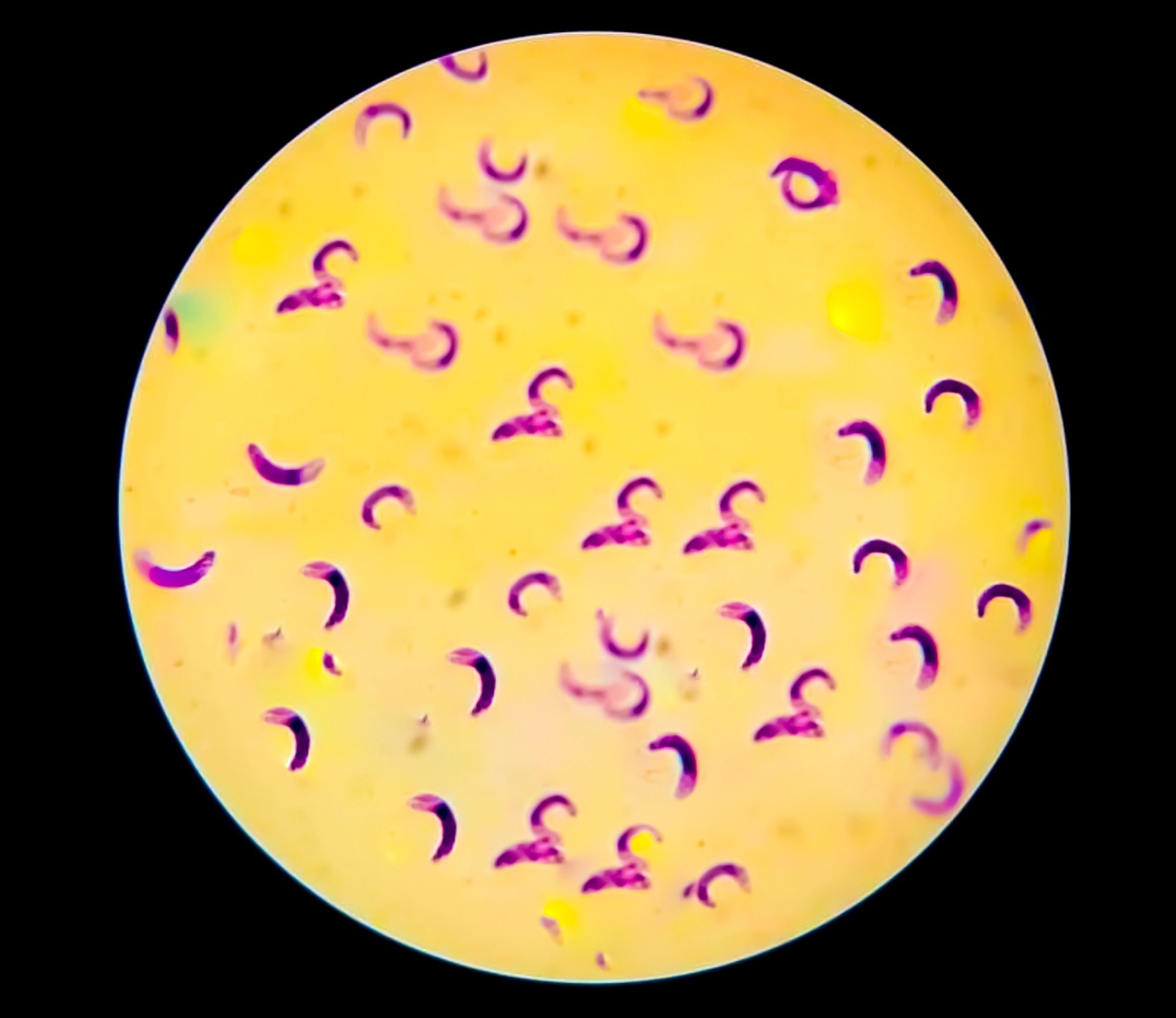 Plasmodium falciparum parasite analysed by light microscope.
