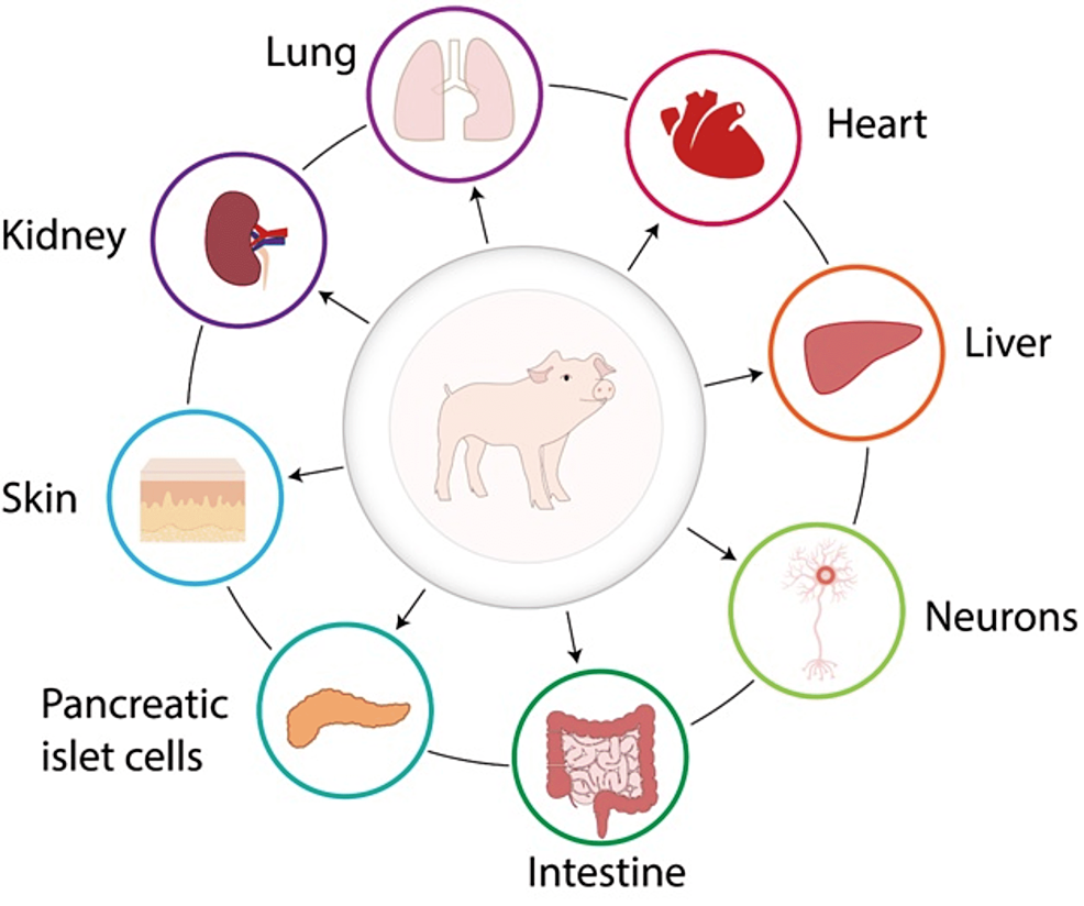 These are the different organs that can be used in xenotransplantation. Pigs
