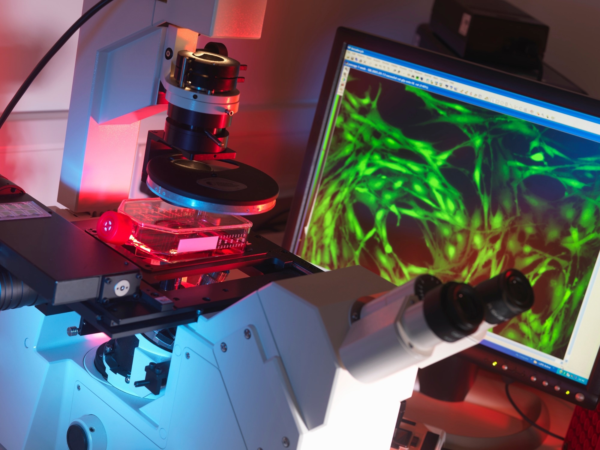 Inverted microscope viewing stem cells in flask with display of a fluorescent labeled cells