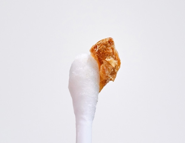 What Your Earwax Says About Your Health