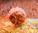 Circadian Oncology: Timing, Cancer Treatment, and Patient Outcomes