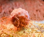 Circadian Oncology: Timing, Cancer Treatment, and Patient Outcomes