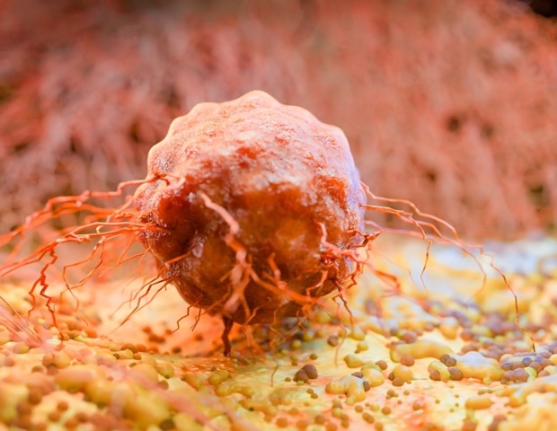 Circadian Oncology: Timing, Cancer Treatment, and Patient Outcomes