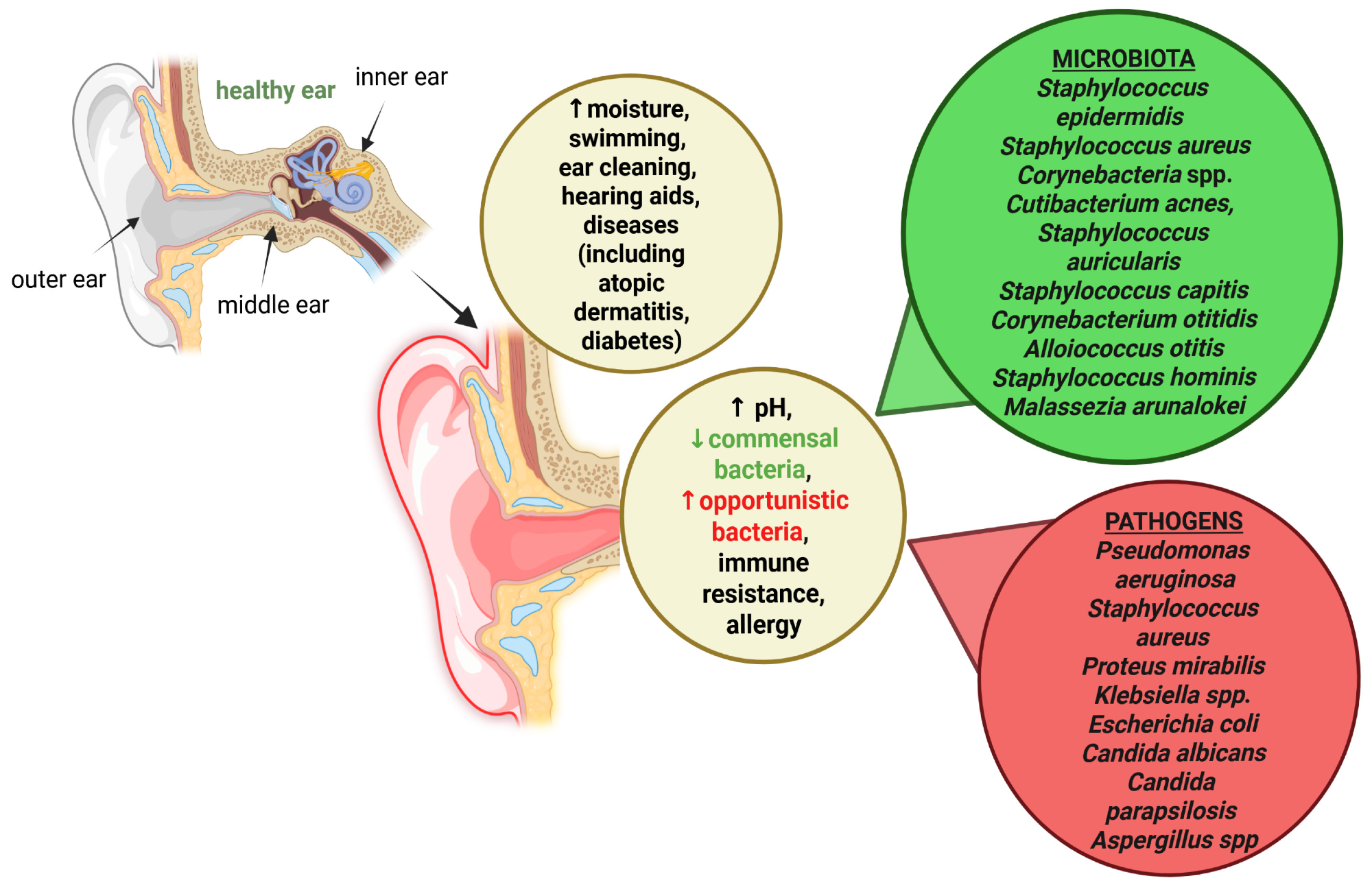 A schematic summary of factors that increase the risk of outer ear infections (otitis externa), highlighting environmental factors (e.g., water exposure and humidity), mechanical damage to the ear canal epithelium, disturbances in cerumen composition, and microbial imbalance, all of which contribute to impaired local immune defense.3