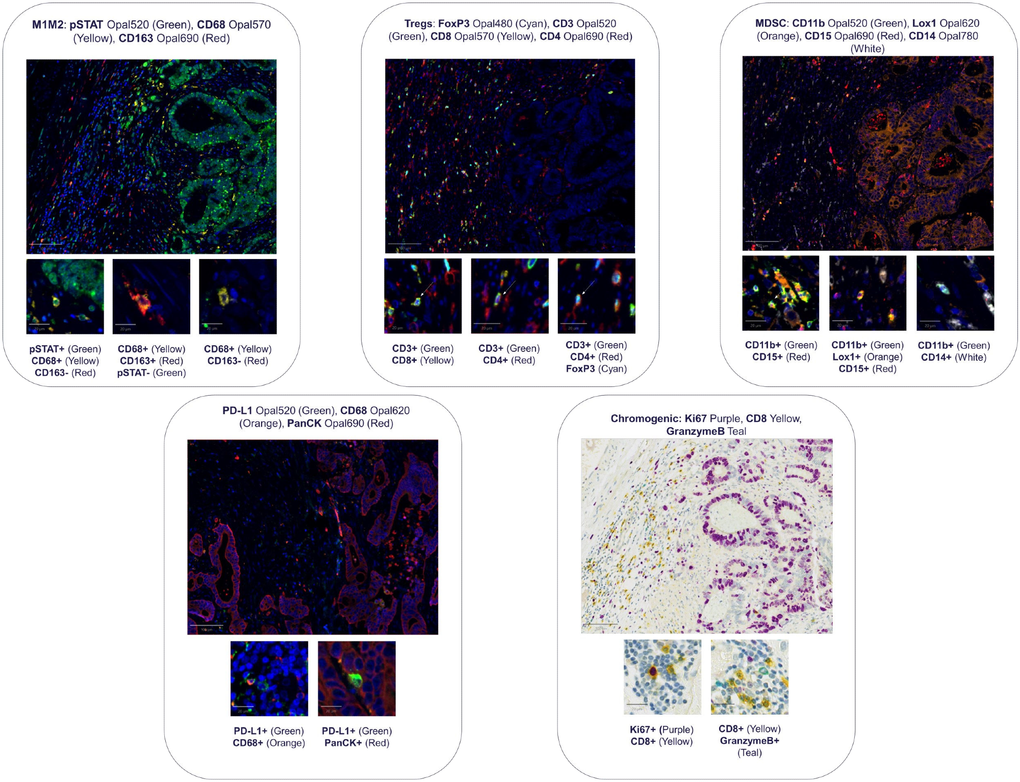 Multiplex IHC panel images are shown at the top of the layout, with the specific targets included for each panel labeled above the corresponding image. Beneath each multiplex panel, the associated phenotype images are presented, with the phenotype markers identified directly below each image