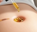 Castor Oil for Health: Benefits, Uses, Side Effects, and Safety