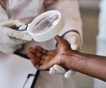 How GLP-1 Drugs May Help Psoriasis and Hidradenitis Suppurativa