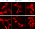 Using live-cell fluorescence to assess SOD1 A4V aggregation in ALS