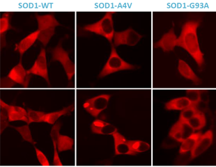 Using live-cell fluorescence to assess SOD1 A4V aggregation in ALS