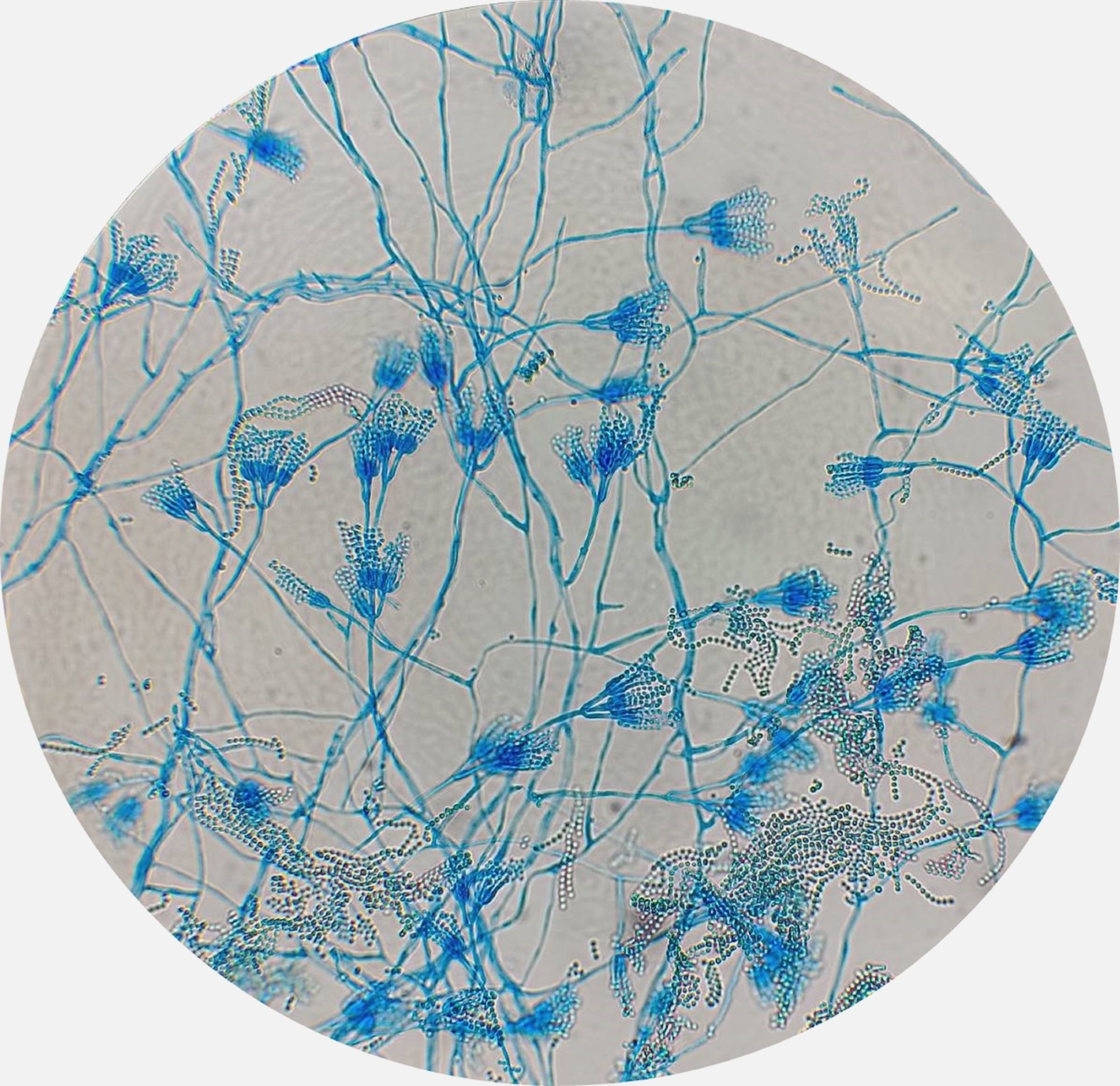 Microscopic image of blue-stained filamentous fungal hyphae, branching conidiophores, and clusters of asexual spores (conidia) X400.