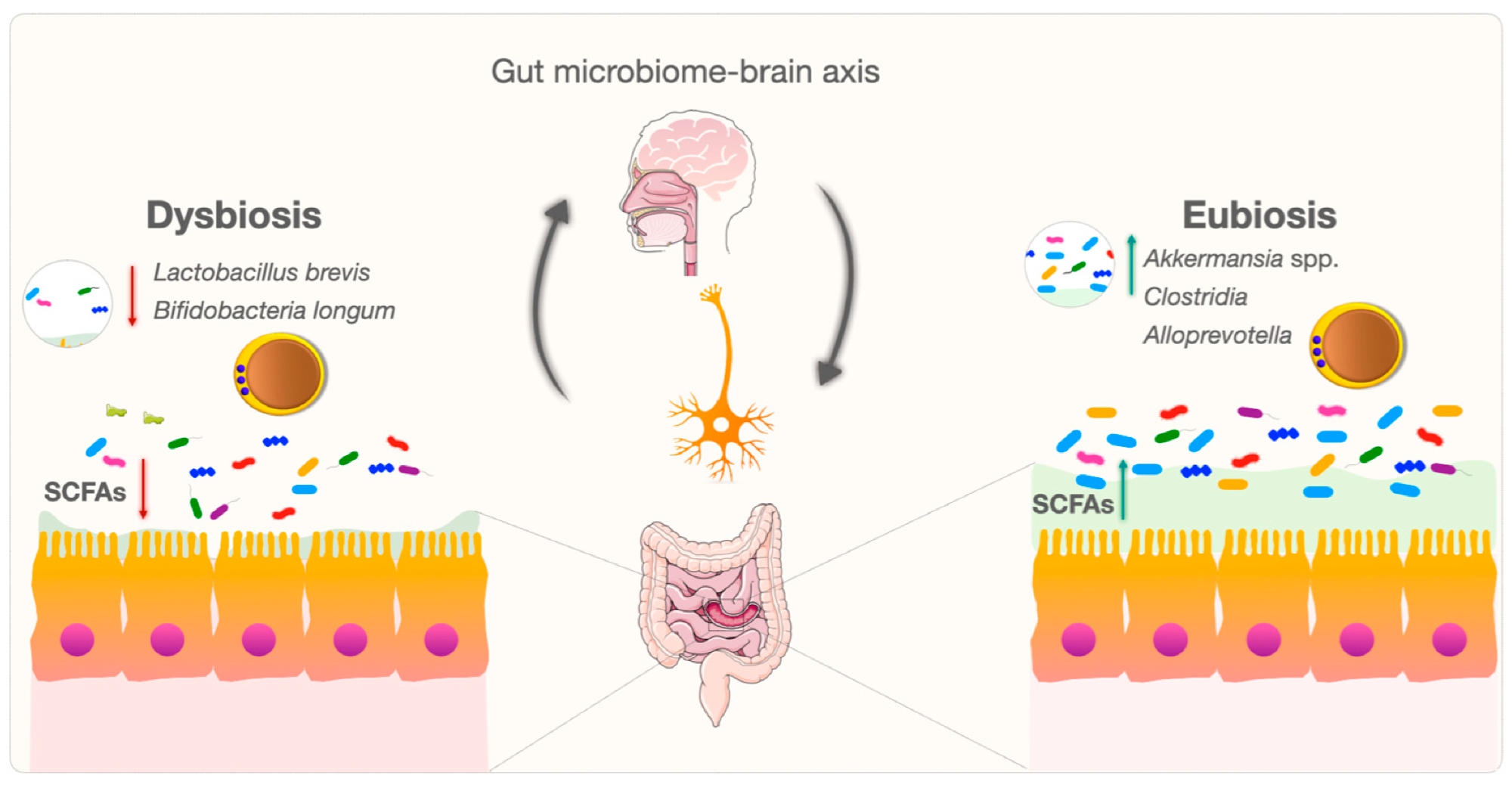 Diagram illustrating the gut–brain axis, contrasting dysbiosis with reduced beneficial bacteria and short-chain fatty acids against eubiosis with greater microbial diversity and metabolite production.
