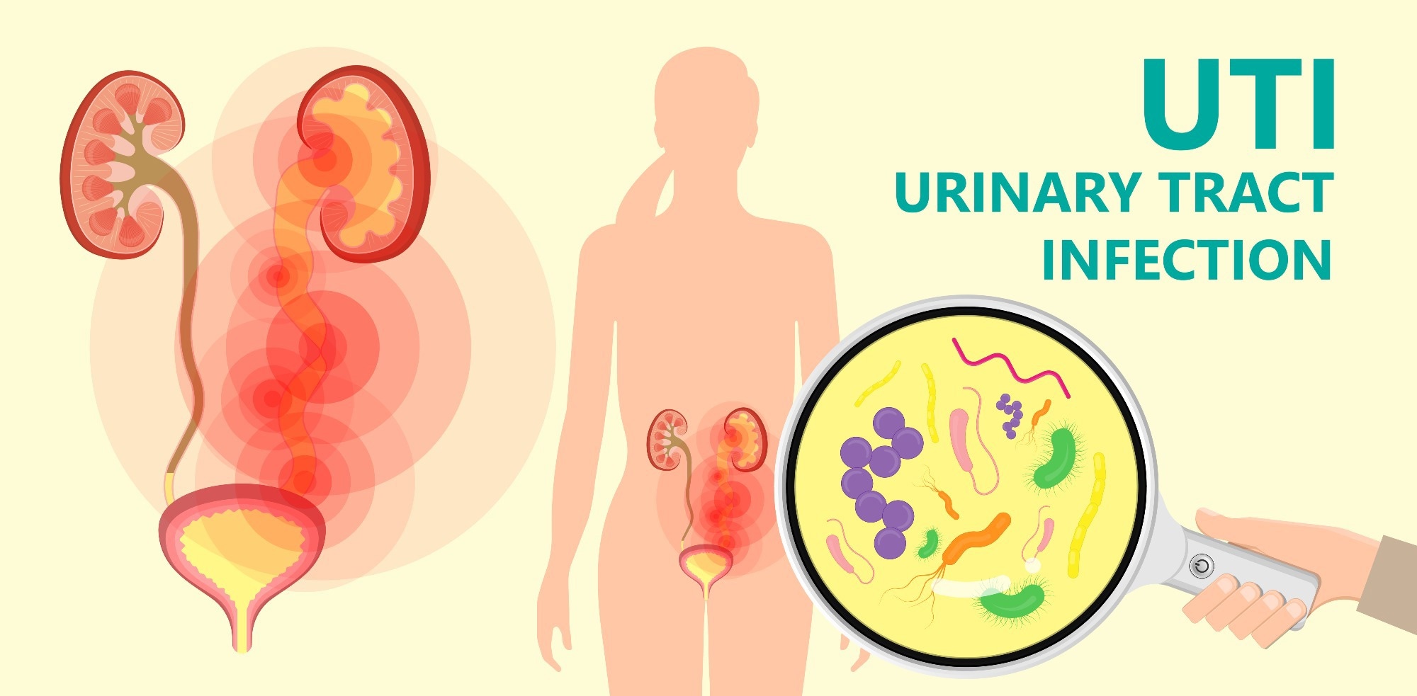 Urinary Tract Infection Symptoms