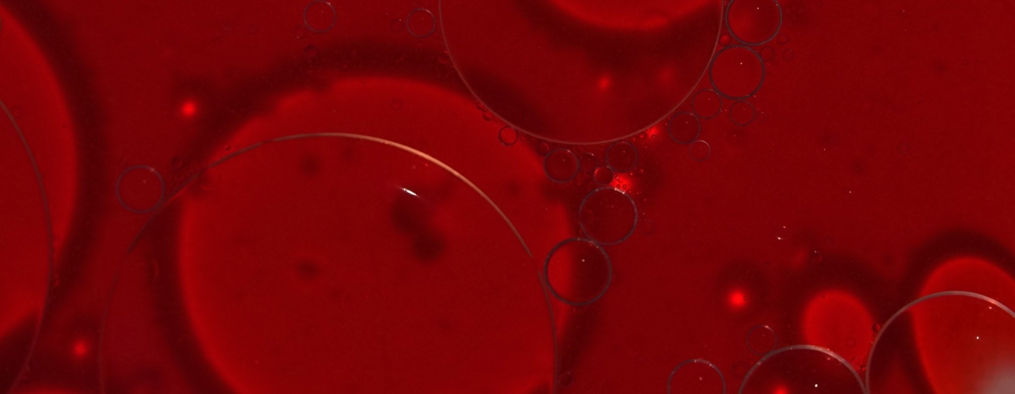 Small shifts in blood sodium may influence human brain excitability