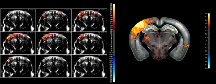 Understanding key differences between conventional and functional ultrasound