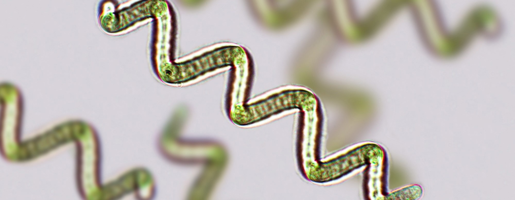 Algae may help meet future protein demand without straining the planet