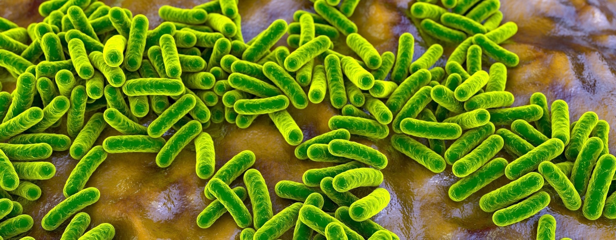 How modern lifestyles reprogram the gut microbiome and shape disease risk