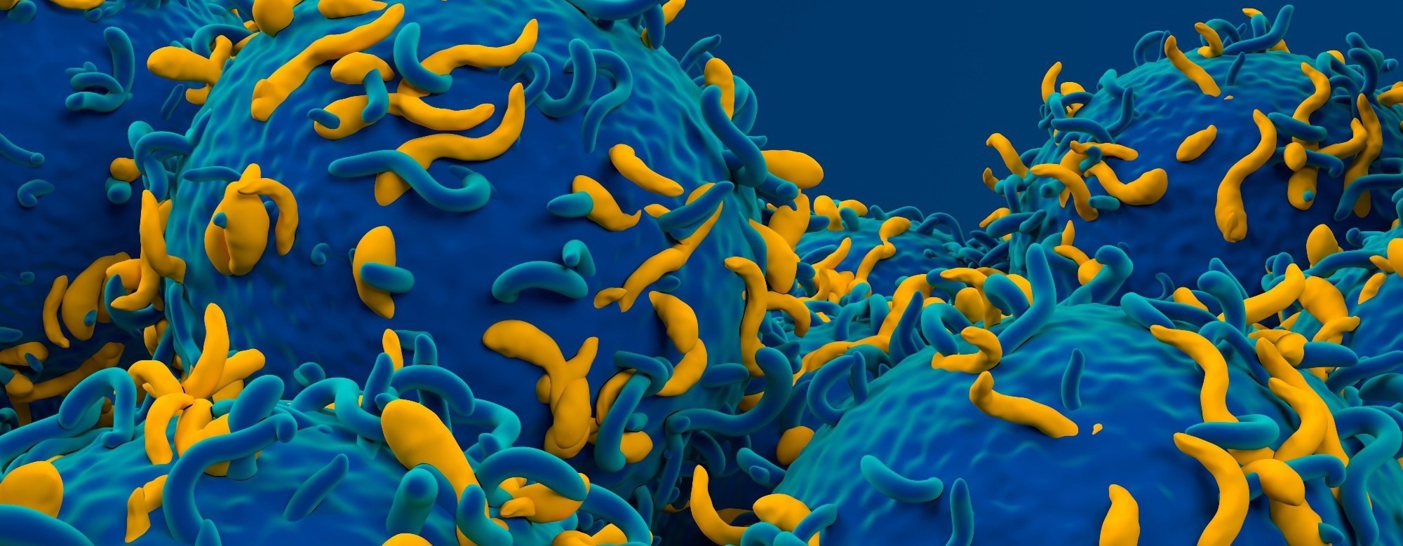 Scientists redesign CAR-T cells to fight more than cancer