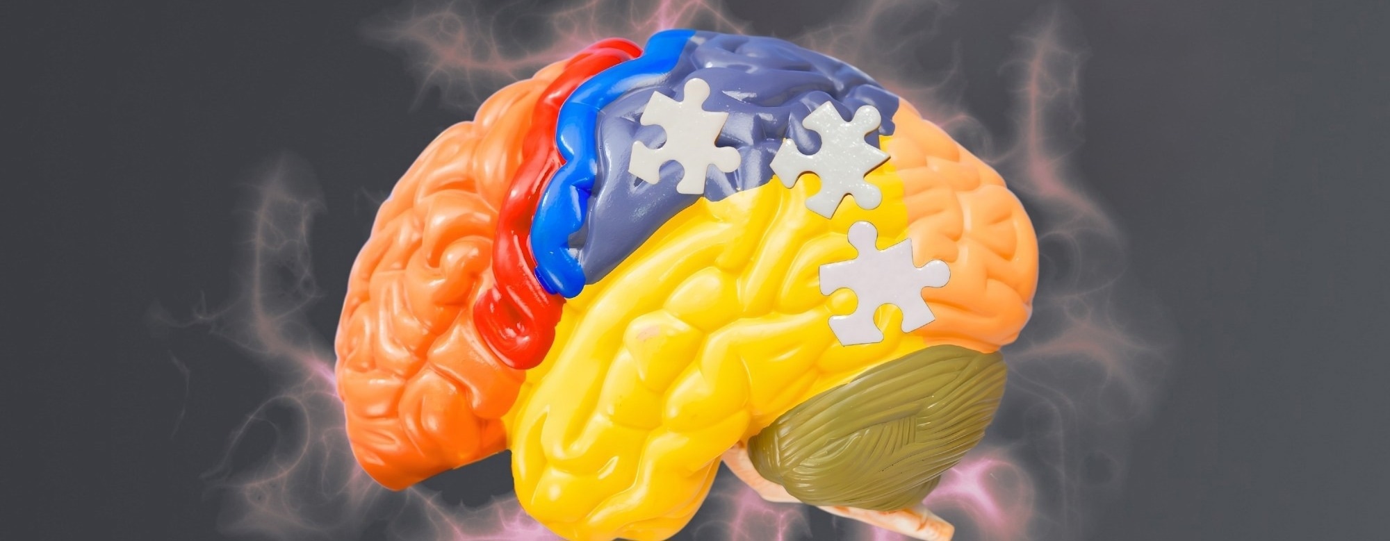 Why new Alzheimer’s drugs are dividing regulators worldwide