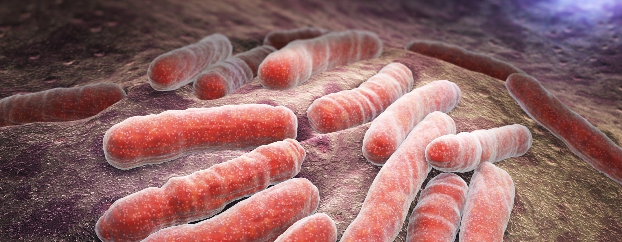 Study links severe COVID to higher TB risk, and vaccination appears to blunt the link