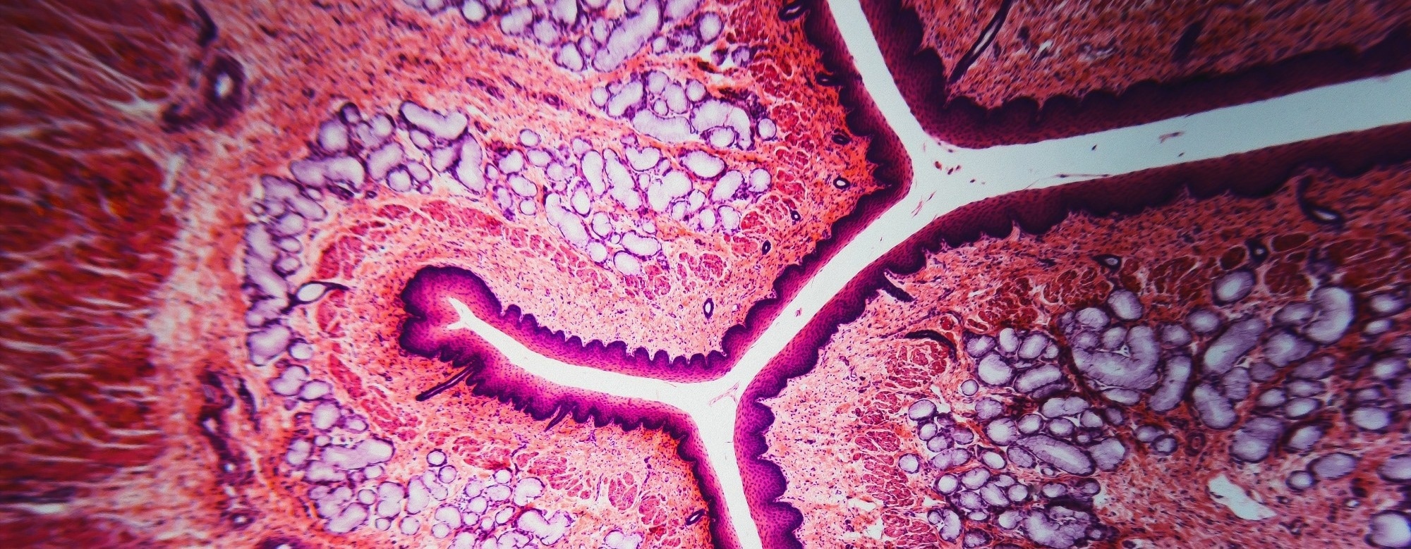 Deep-learning tissue clocks reveal how organs age and leave disease-linked signals in blood