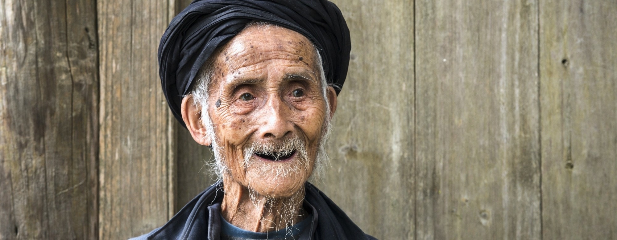 A striking immune cell pattern emerges around a person’s 100th birthday