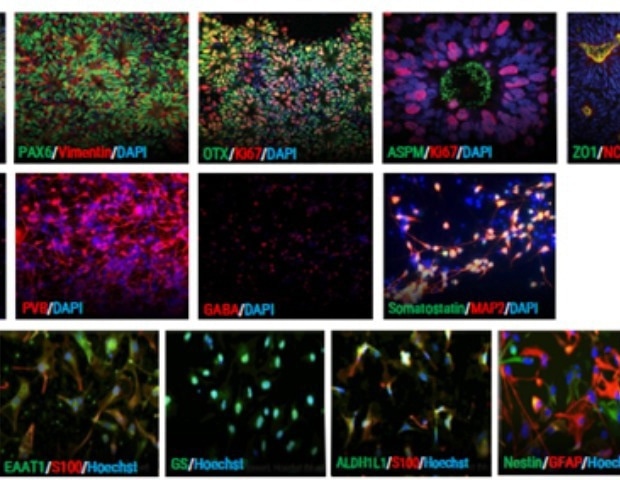Validating a tri-culture cortical model to advance neurodegenerative drug discovery