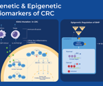 Genetic and stool-based biomarkers enhance early colorectal cancer (CRC) detection