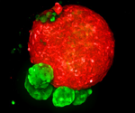 High-content analysis and its role in live-cell imaging